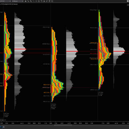 Session TPO Profile - Image 3